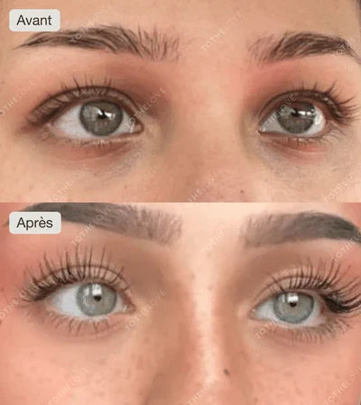 The before/after with Tothelove eyelash serum